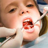 Уход за детскими зубами 